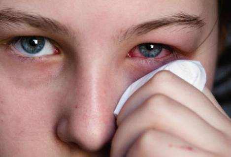 Common Eye Infections Bacterial, Fungal and Viral