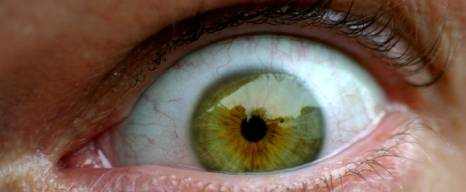 Eye Floaters Causes, Symptoms and Treatment