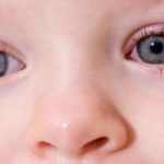 How Long Is Pink Eye Contagious in Children and Adults