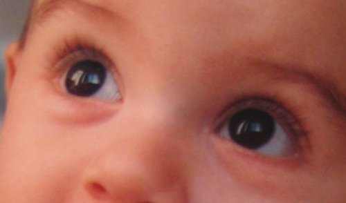 Infant's Vision Development