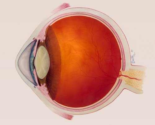 Keratoconus - Eye Diseases