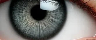 Eye