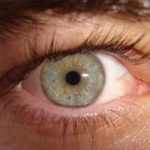 How to Reduce Eye Number