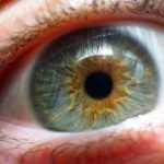 Is LASIK Eye Surgery Permanent?