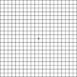 Amsler Grid Test for Macular Degeneration | EYExan.com