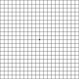 Amsler Grid Test for Macular Degeneration | EYExan.com