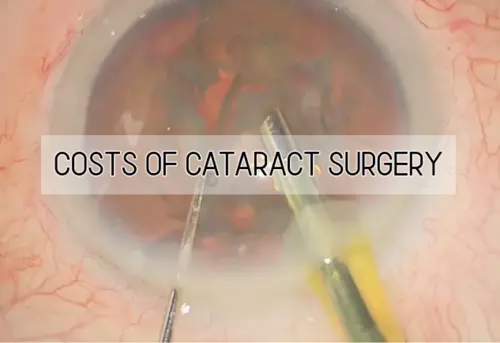 costs of cataract surgery