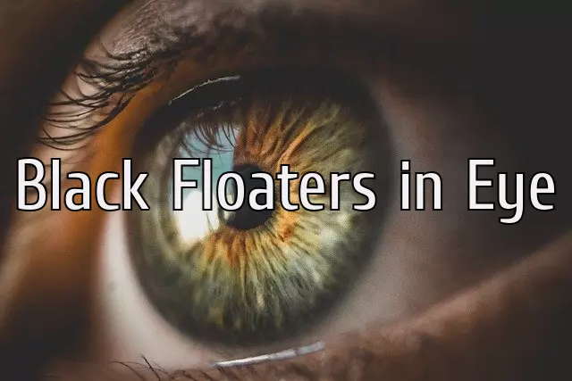 Black Floaters in Eye