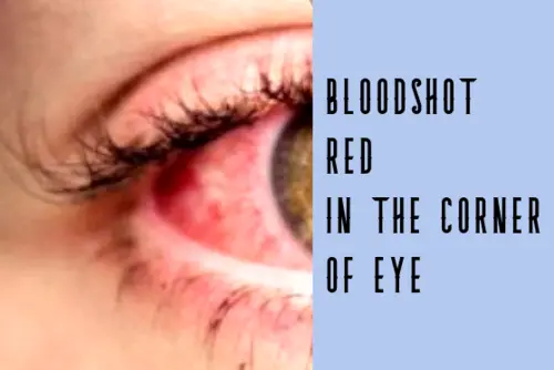 bloodshot red in the corner of eye