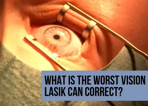 What Is the Worst Vision LASIK Can Correct?
