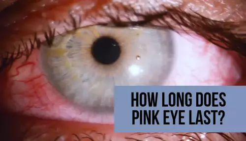 How Long Does Pink Eye Last?