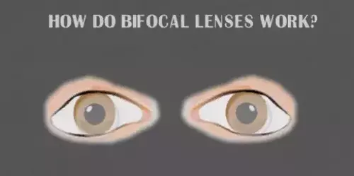 Bifocal Contact Lenses on Eyes