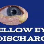 Yellow Eye Discharge