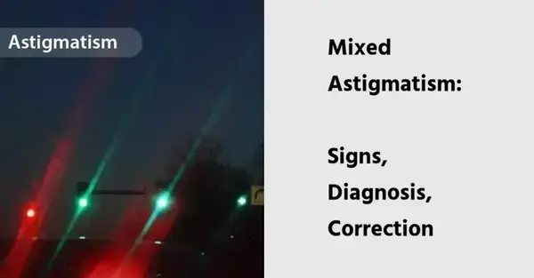 Mixed Astigmatism: Signs, Diagnosis, Correction Methods
