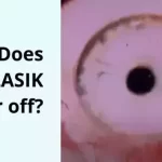 How Long Does LASIK Last?