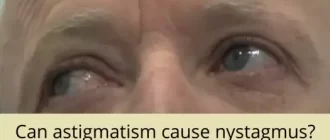 Can astigmatism cause nystagmus?
