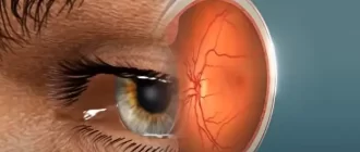 Signs of Retinal Damage