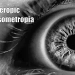 Hyperopic Anisometropia